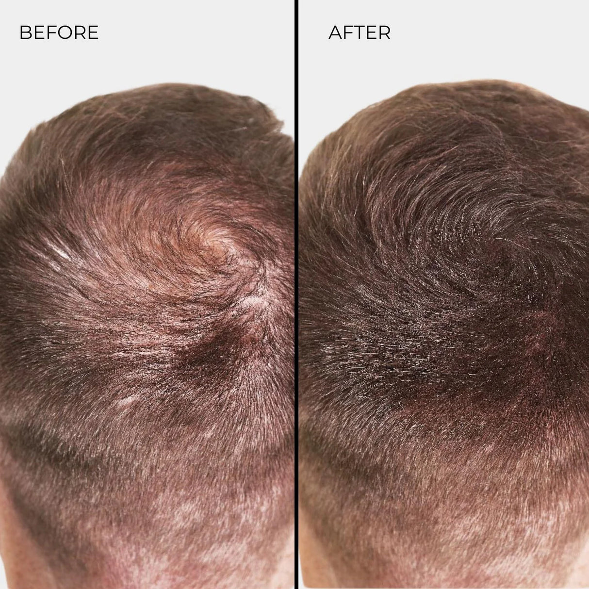 Nanogen Hair Thickening Fibre Auburn - BVShop