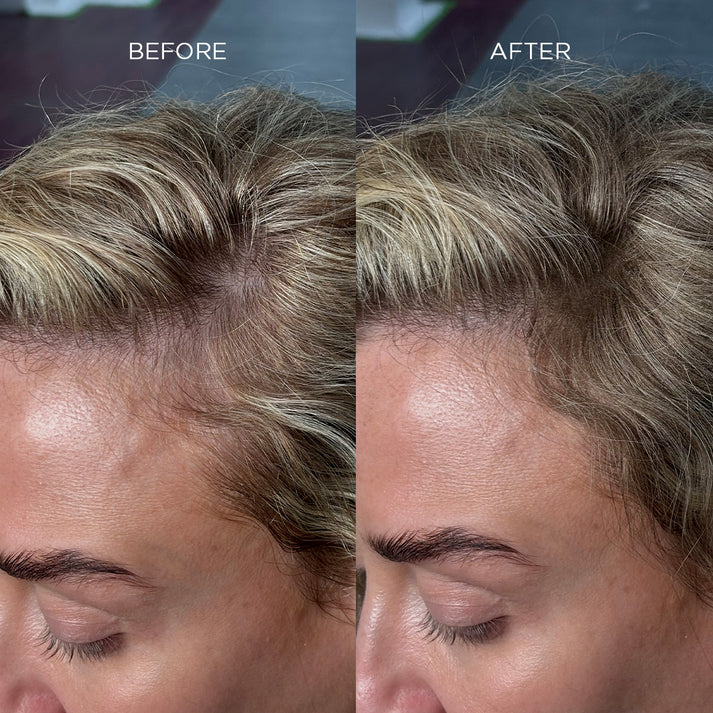 Nanogen Hair Thickening Fibre White