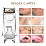 Skin Monarch Quantum Pro Diode & Picosecond Laser