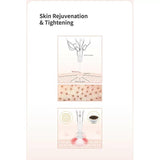 BOMTECH Renouveau Plasma Pen - BVShop